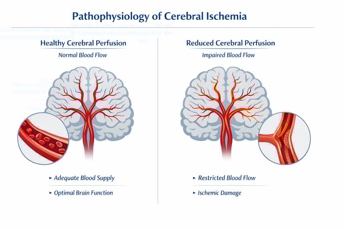 Healthy vs Reduced Cerebral Perfusion