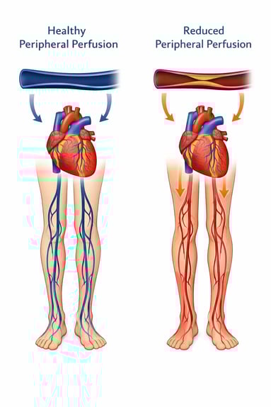 Healthy vs Reduced Peripheral Perfusion