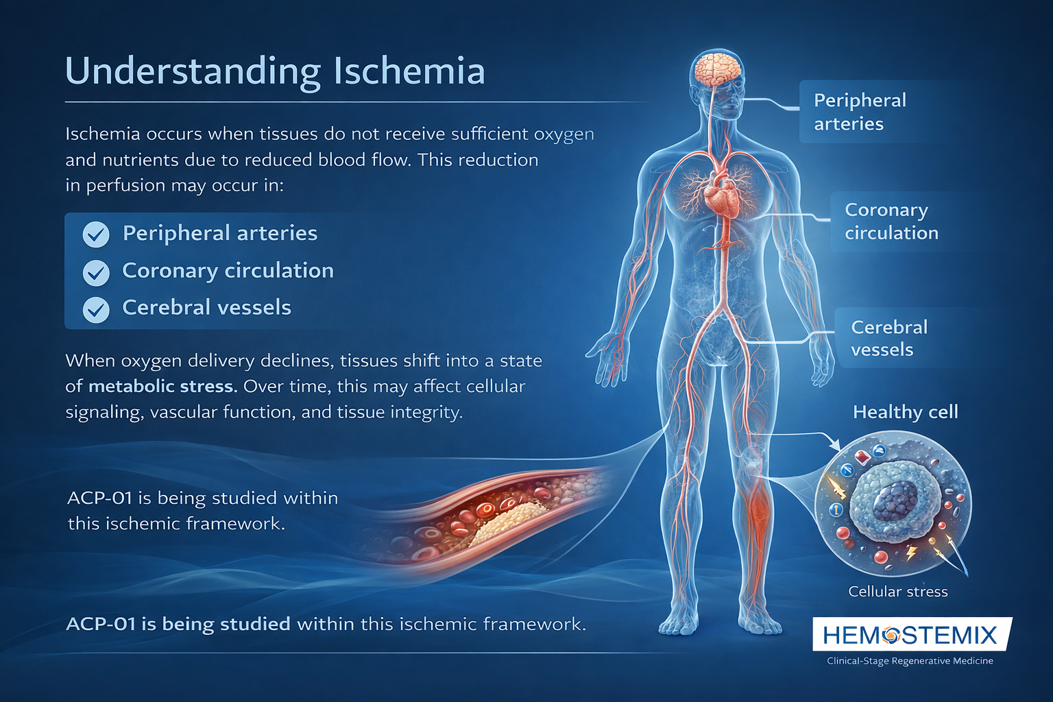 understanding ischemia understanding ischemia